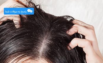 برطرف کردن موهای چرب سر