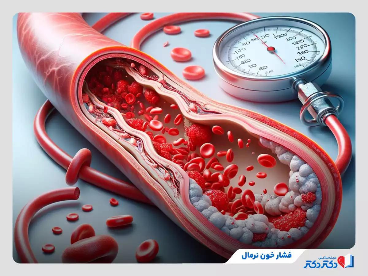 فشار خون نرمال چقدر است؟ + جدول فشار خون طبیعی برای تمام سنین