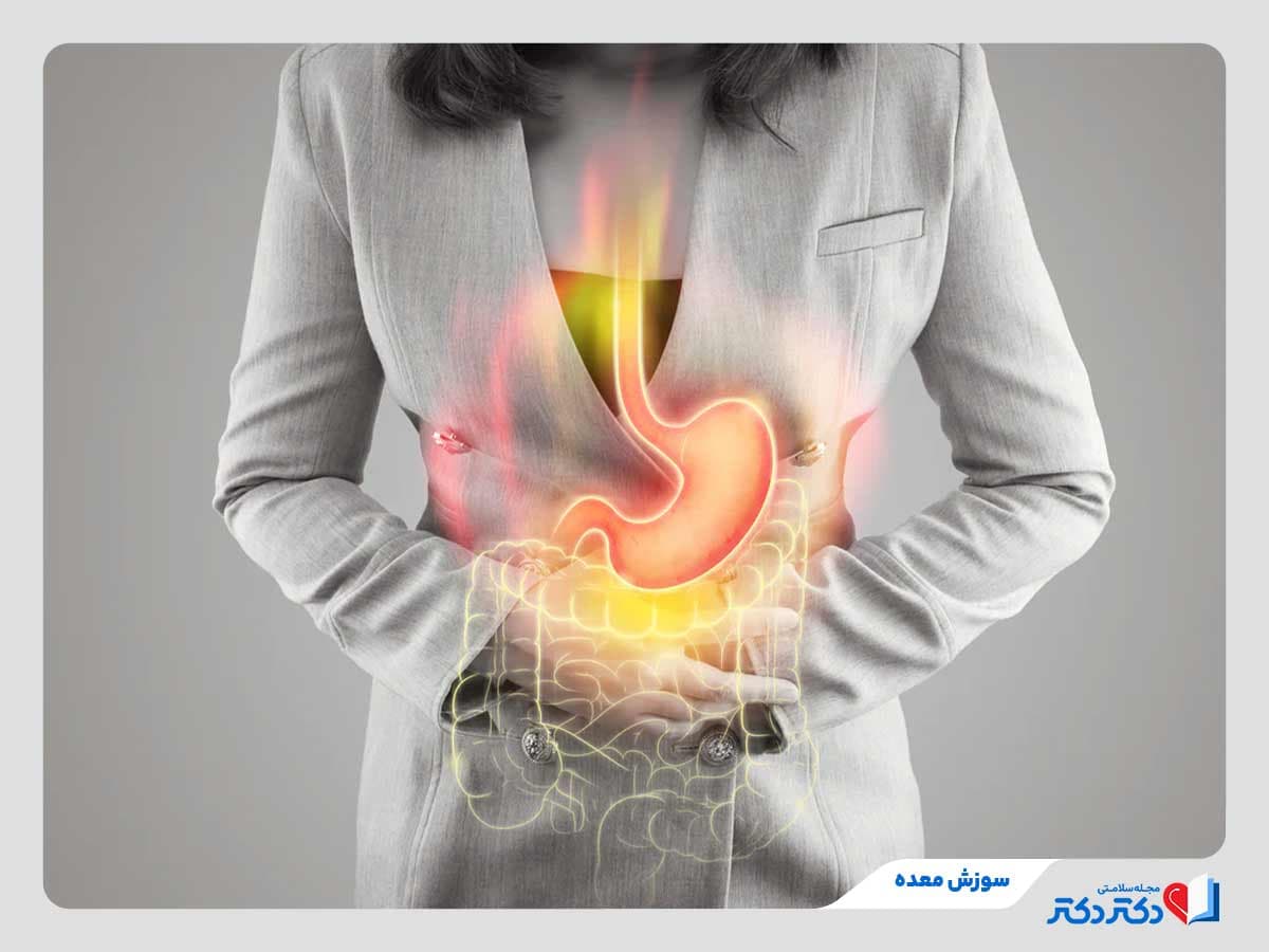 سوزش معده چیست و چرا به آن مبتلا می‌شویم؟ + روش‌های پیشگیری و درمان