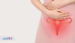 ترشحات خونی واژن؛ علل، علائم و راه‌های پیشگیری