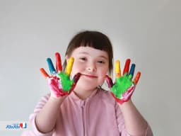 سندرم داون چیست و چه علائمی دارد | تشخیص، علت و طول عمر افراد مبتلا