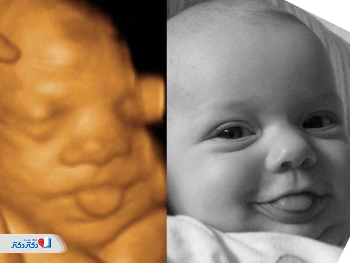 سونوگرافی چهار‌بعدی؛ تصاویر زنده از حرکات واقعی جنین