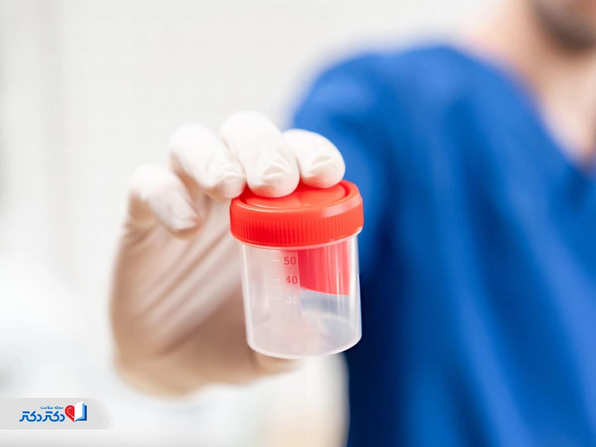 همه چیز درباره نحوه انجام آزمایش اعتیاد و نکات مهمی که قبل از انجام تست اعتیاد باید بدانید