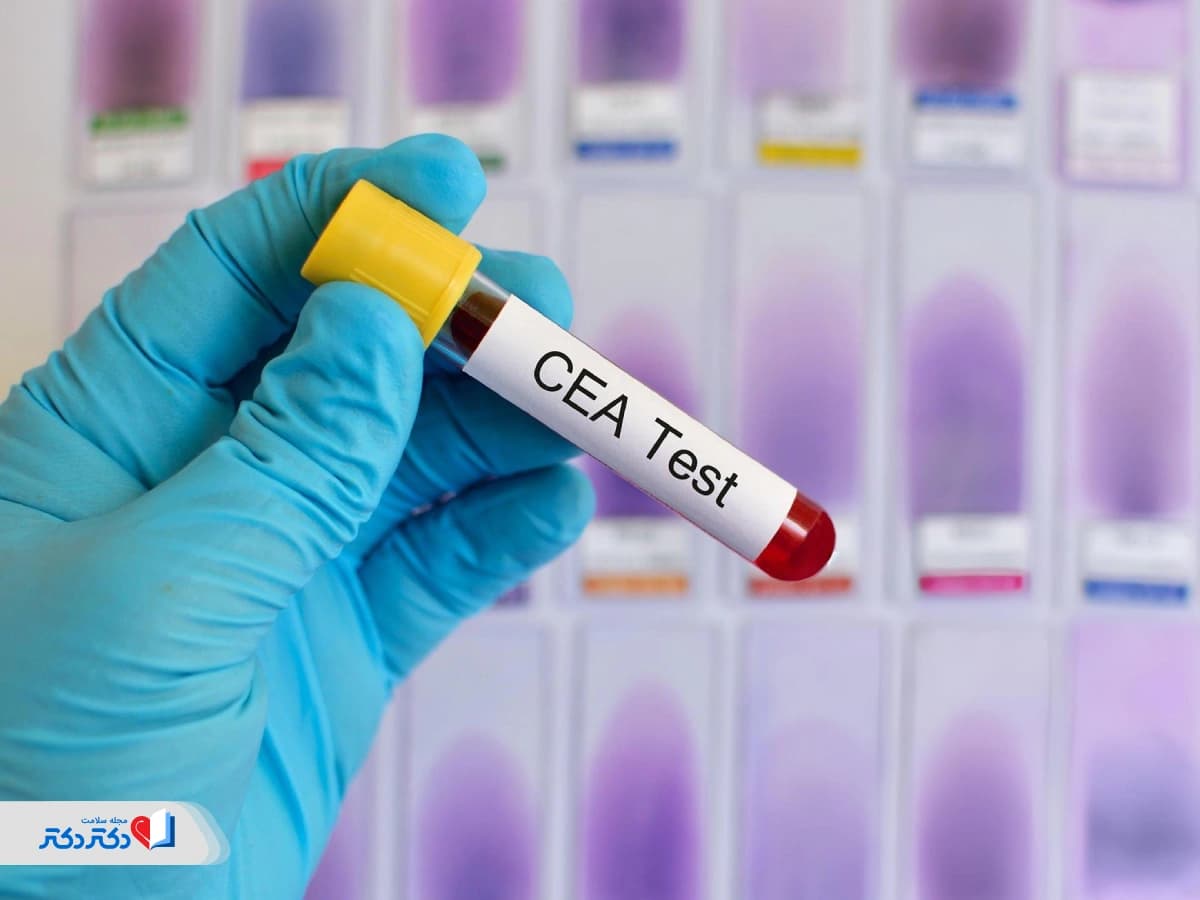 آزمایش CEA در خون چیست؟ رنج نرمال و موارد کاربرد آن