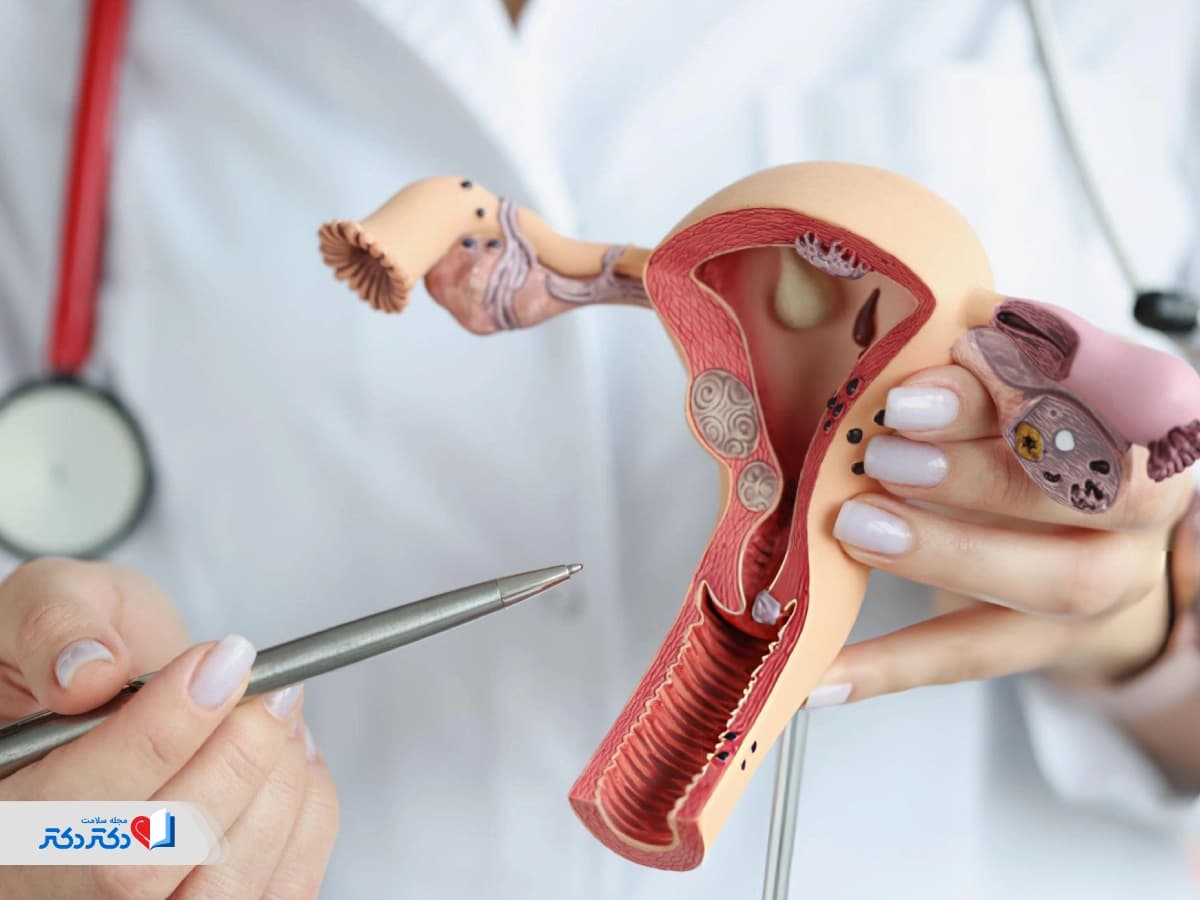 سرطان دهانه رحم چیست؟ علائم هشداردهنده، علت و روش‌های درمان