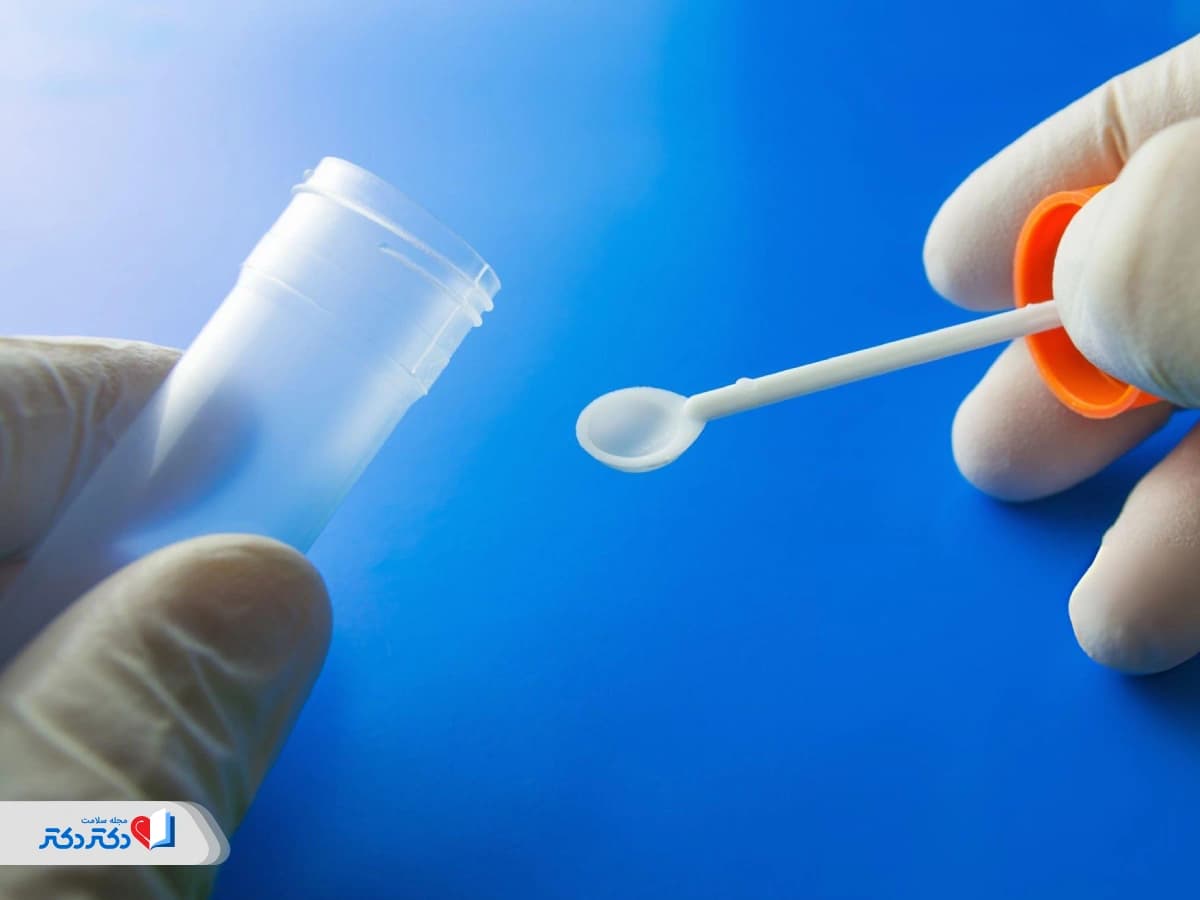 آزمایش مدفوع: روش‌ها، تفسیر نتایج و نکات مهم قبل از انجام آزمایش