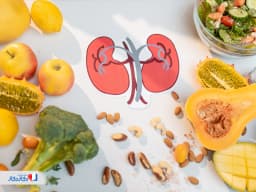 برای دفع سنگ کلیه چه بخوریم؟ + لیست غذاهای مناسب دفع سنگ کلیه