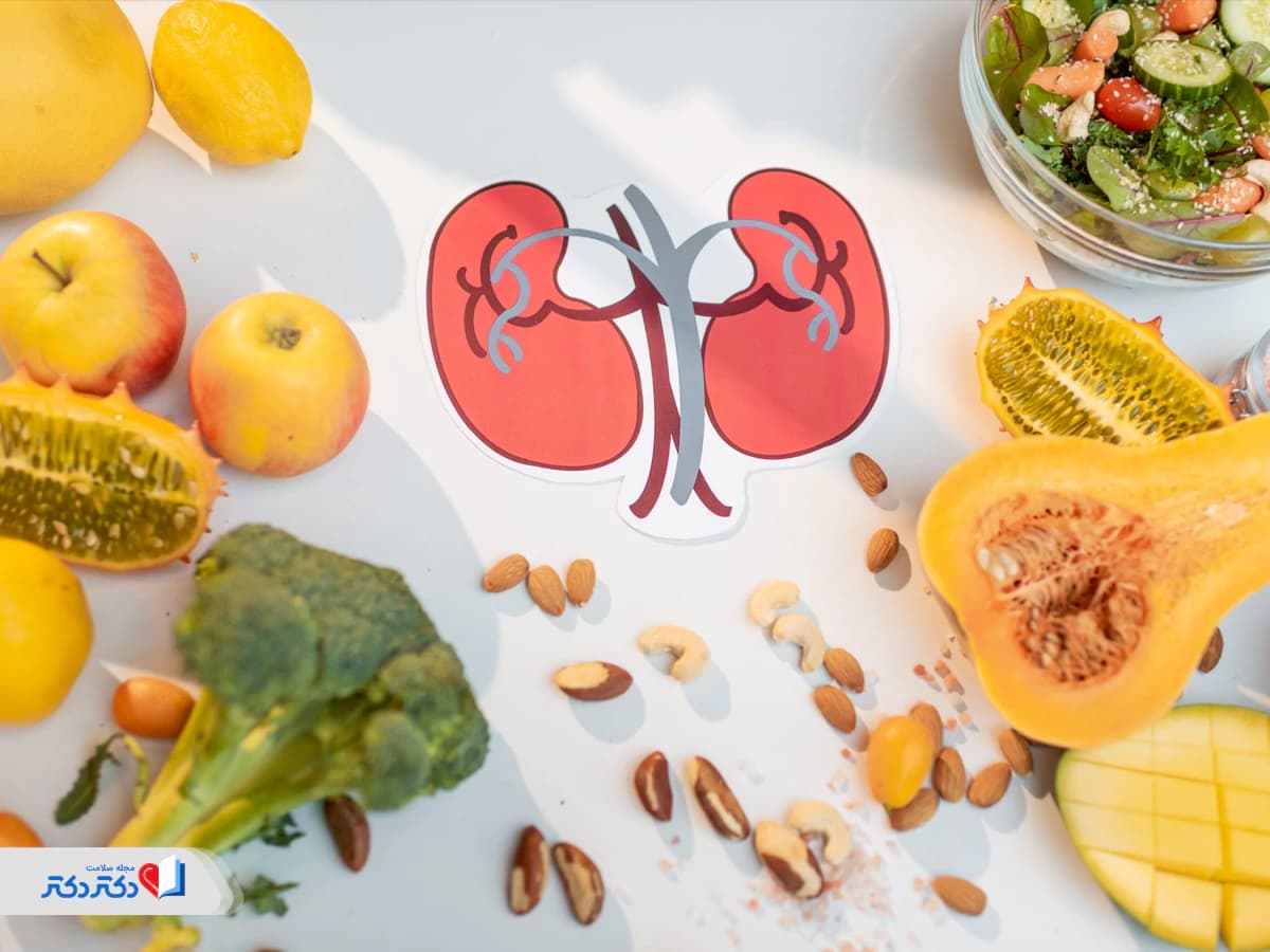 برای دفع سنگ کلیه چه بخوریم؟ + لیست غذاهای مناسب دفع سنگ کلیه