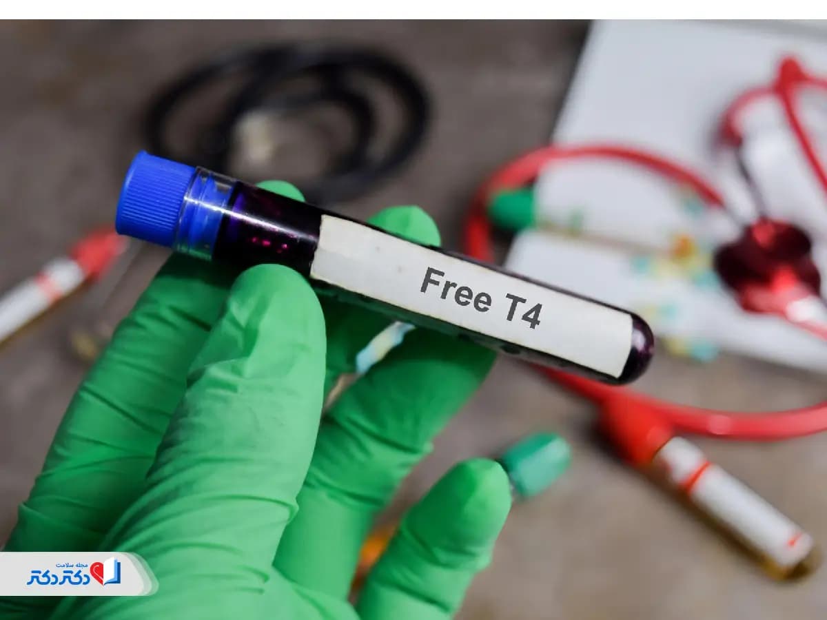 آزمایش T4 چیست و چه نقشی در تشخیص اختلالات تیروئید دارد؟