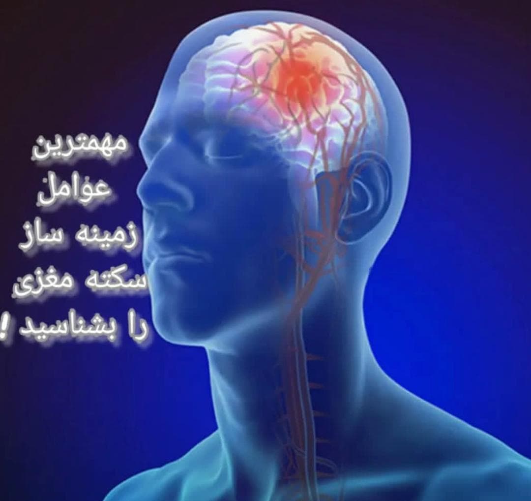 alt عوامل سکته مغزی