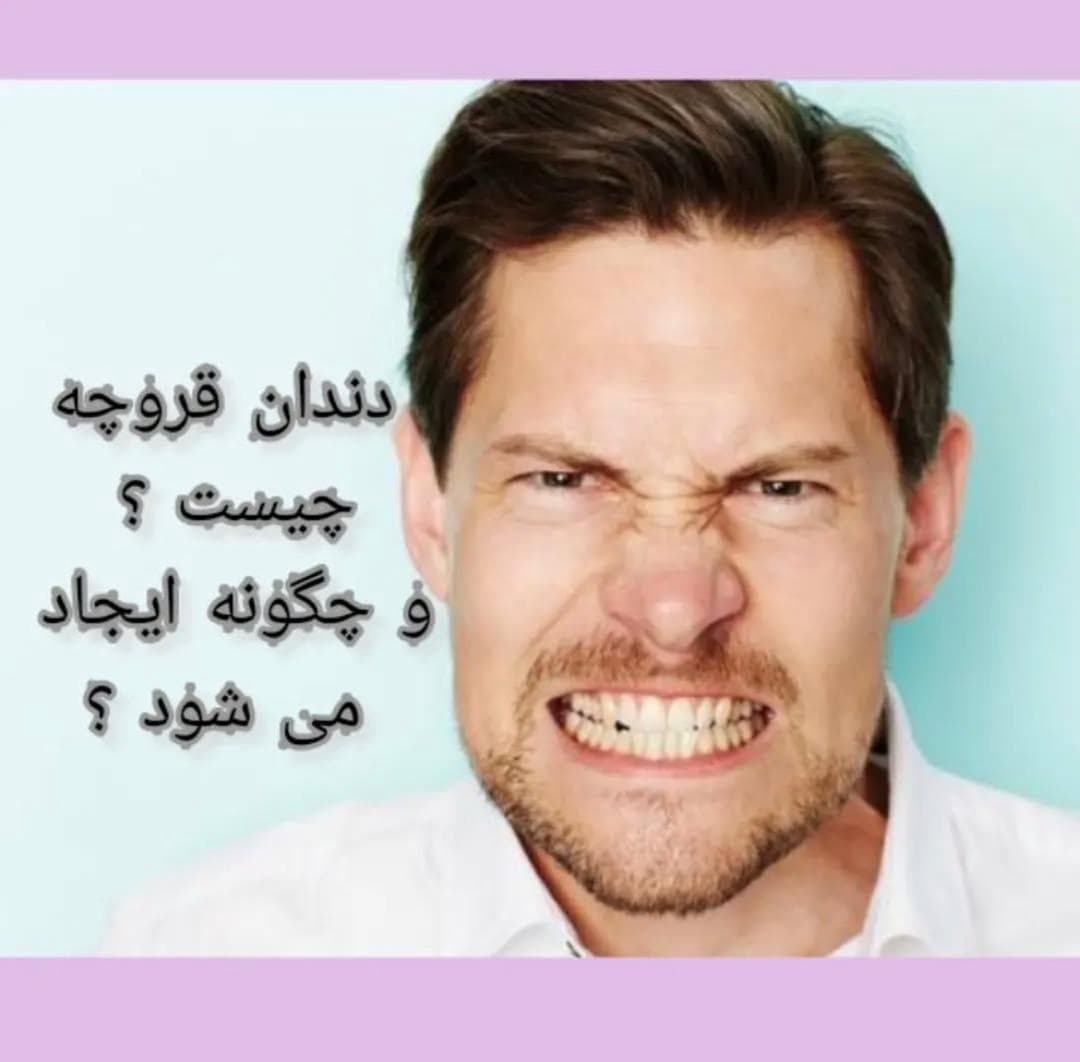 alt دندان قروچه