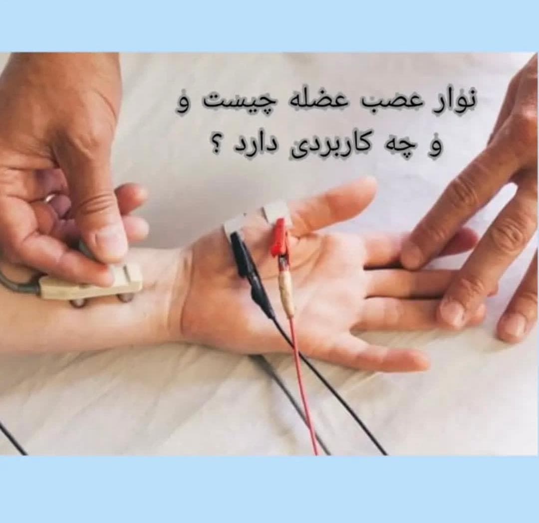 alt نوار عصب عضله