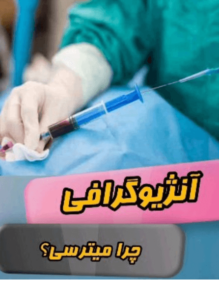 alt آنژیوگرافی