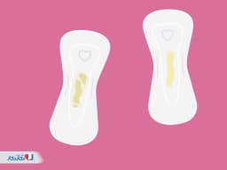 علت ترشحات زرد رنگ واژن چیست؟ آیا طبیعی است؟