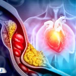 بلوک قلبی چیست؟ بررسی کامل علائم، درجات و روش‌های درمان