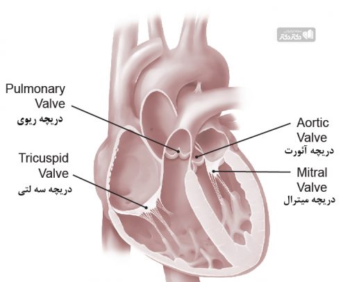انواع بیماری های دریچه های قلب