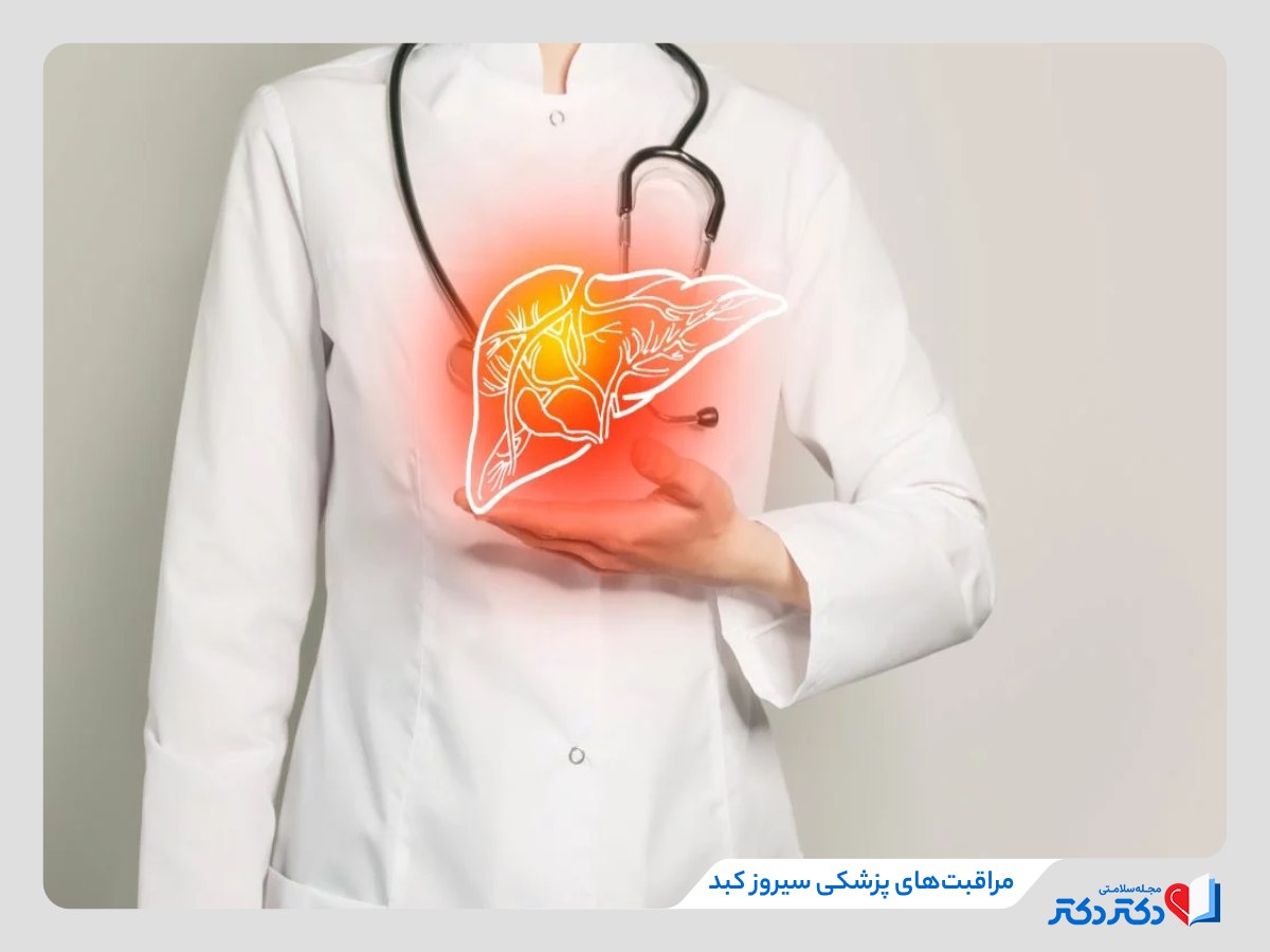 مراقبت های سیروز کبدی