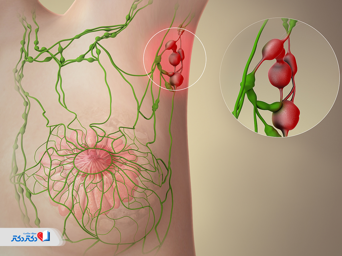 همه‌چیز درباره غدد لنفاوی