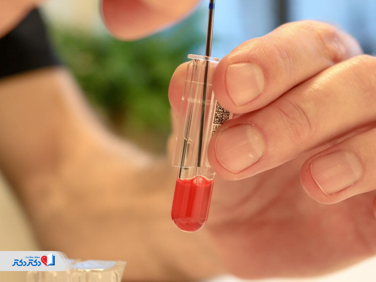 آزمایش خون برای تشخیص لنفوم