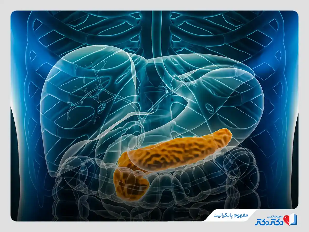 تصویر نشان دهنده التهاب پانکراس علت بیماری پانکراتیت