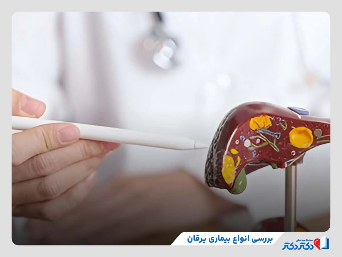 انواع بیماری یرقان