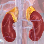 غدد فوق کلیوی؛ علائم بیماری و نحوه پیشگیری