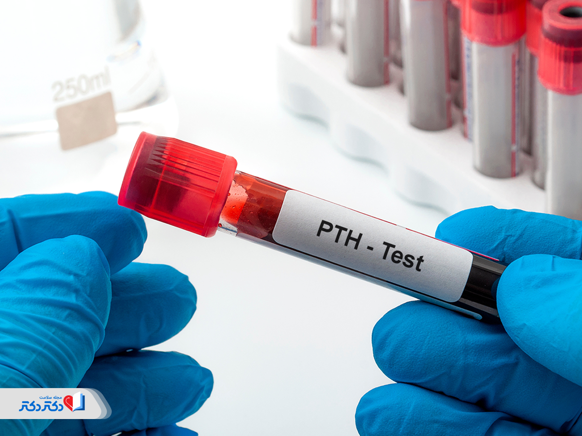 تشخیص پرکاری غده پاراتیروئید در آزمایش خون