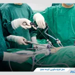 عمل لاپاراسکوپی کیسه صفرا چگونه انجام میشود؟ دلایل و مزایای عمل