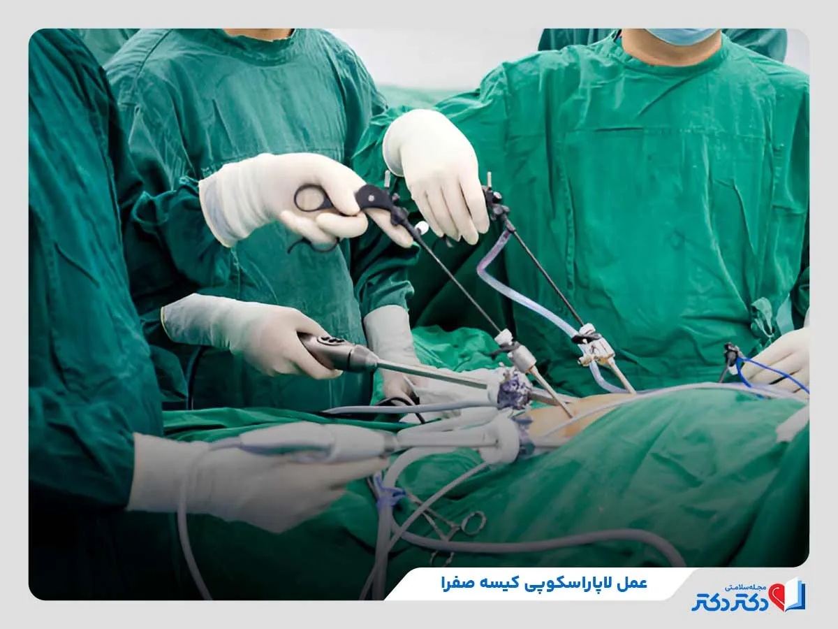 عمل لاپاراسکوپی کیسه صفرا