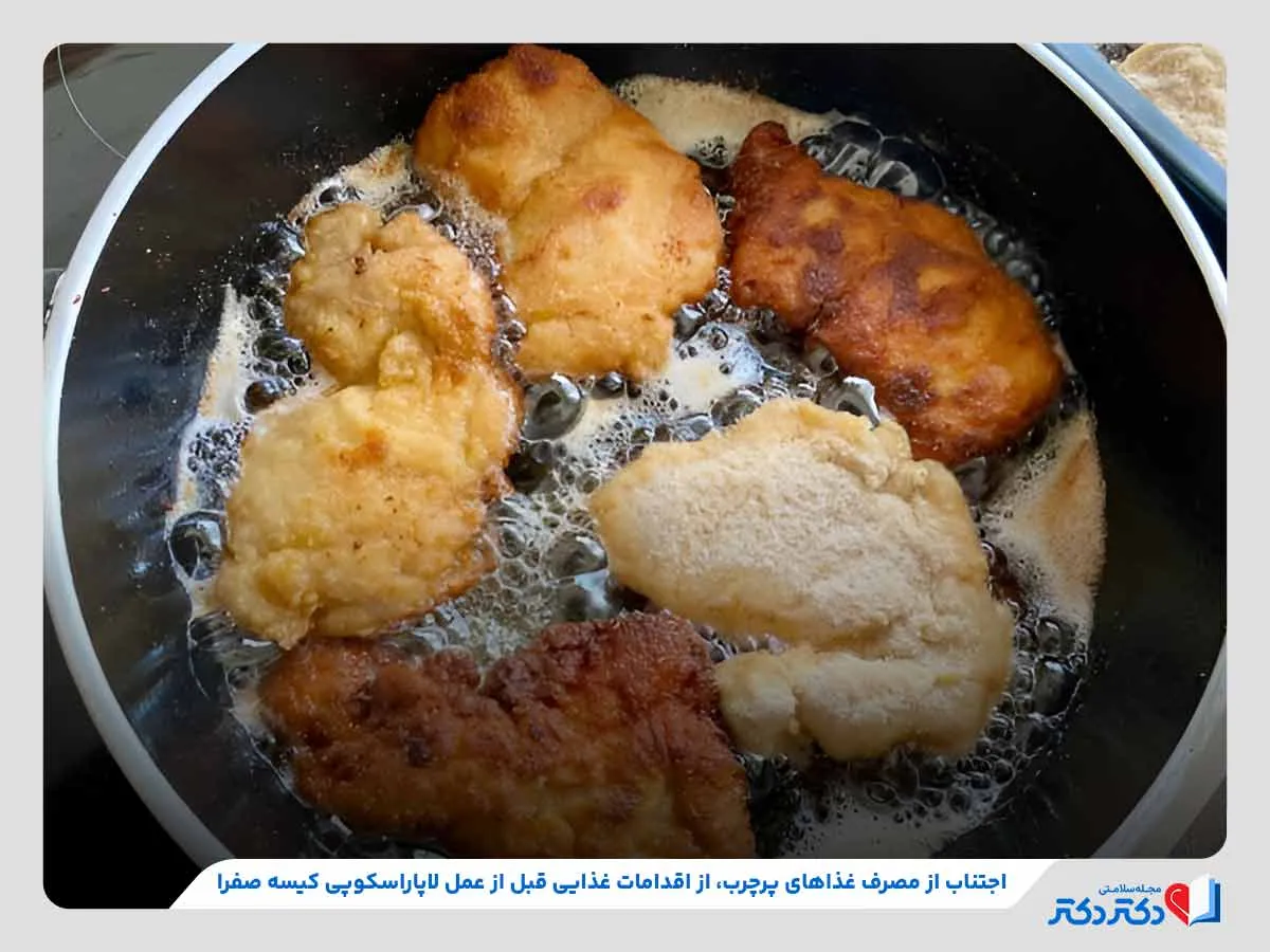 تغییرات رژیم غذایی مانند اجتناب از مصرف غذاهای پرچرب قبل از عمل لاپاراسکوپی