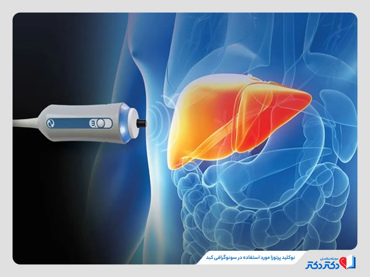 سونوگرافی کبد و استفاده از نوکلید پرتوزا