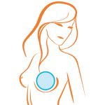 روش‌های بازسازی و ترمیم پستان پس از عمل برداشتن سینه