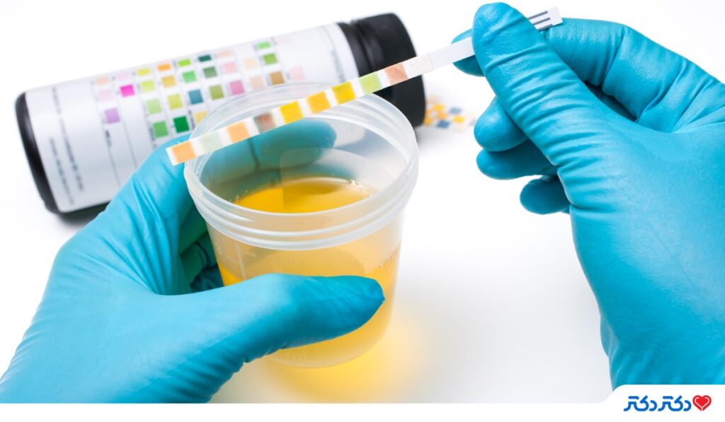 سنگ کلیه چگونه تشخیص داده می‌شود؟ معرفی روش‌های قطعی