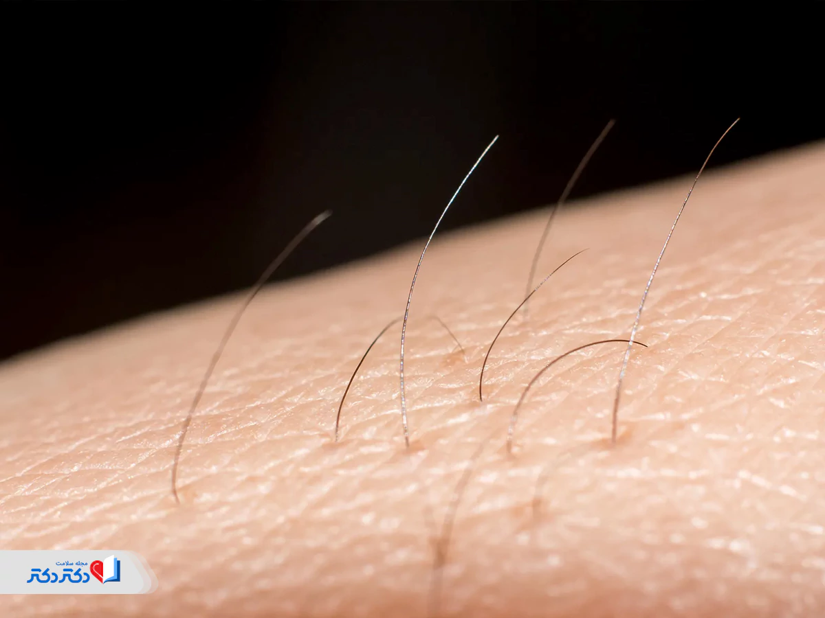 اجتناب از شیوکردن موی زائد برای پیشگیری از زگیل تناسلی