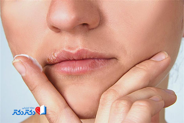 لیزر موهای زائد بدن