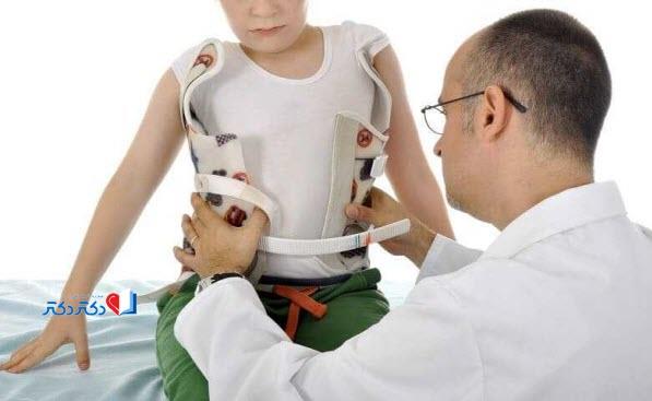 بریس برای اسکولیوز