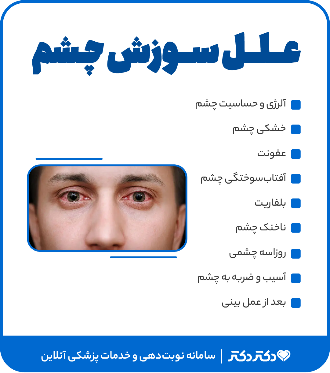 اینفوگرافی علت سوزش چشم