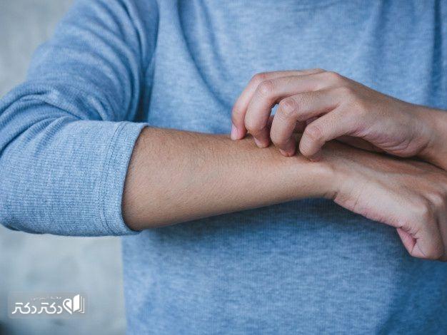 بیماری گال چیست و چه علائمی دارد؟