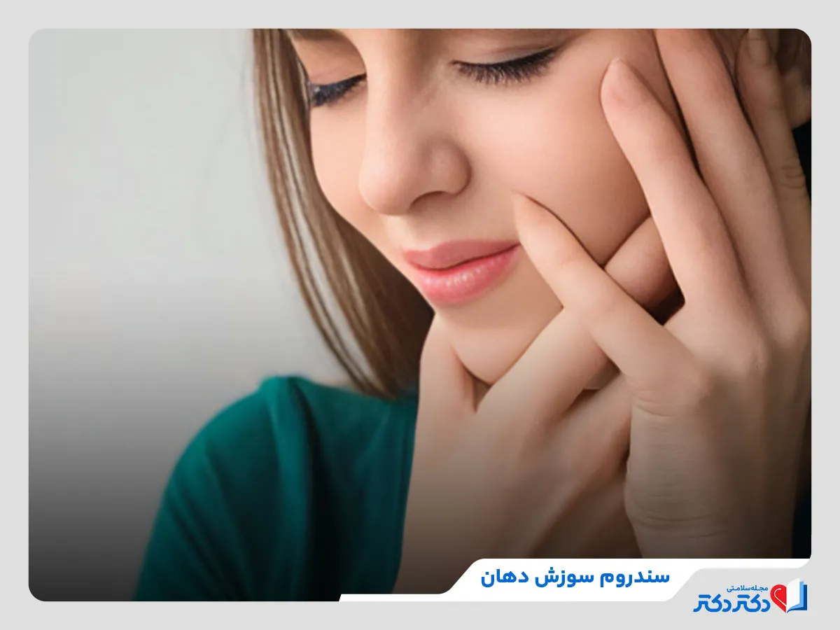 سندروم سوزش دهان