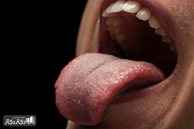 روش تشخیص علت درد زبان