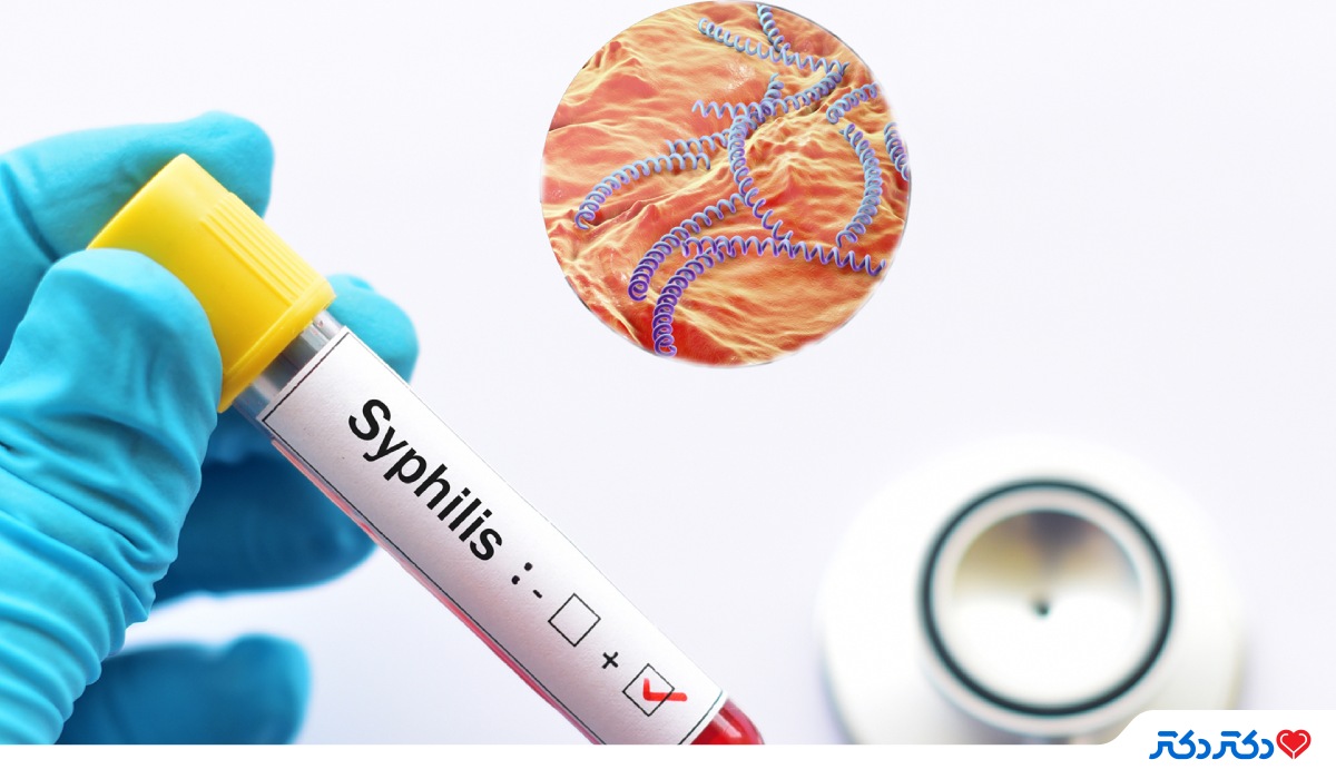 درمان سیفلیس با پنی سیلین