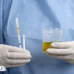 همه چیز درباره آزمایش ادرار؛ تفسیر کامل آزمایش ادرار