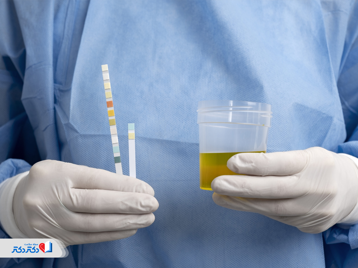 همه‌چیز درباره آزامایش ادرار