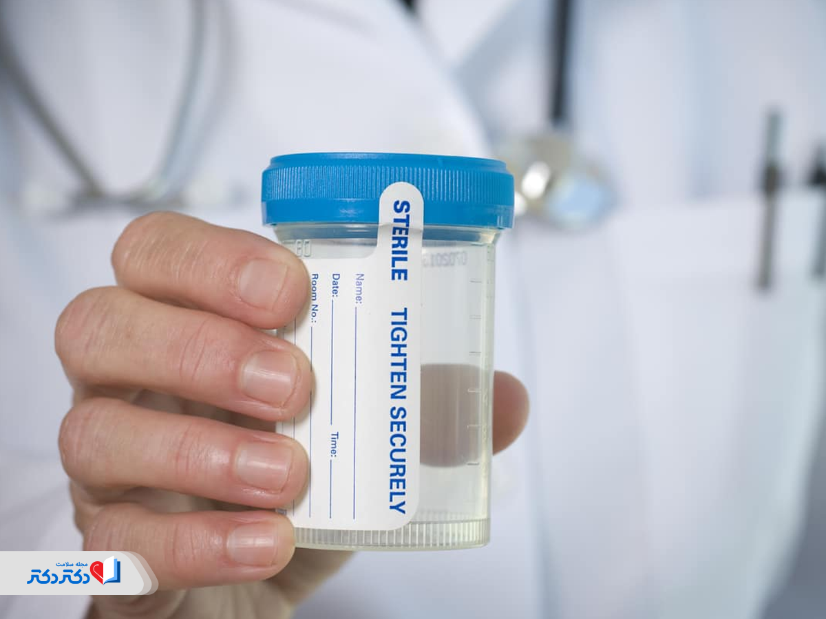 آزمایش ادرار ۲۴ساعته و سنجش نوسان شبانه‌روزی غلظت ادرار