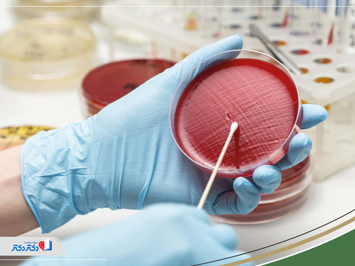 کشت ادرار برای بررسی میکروب