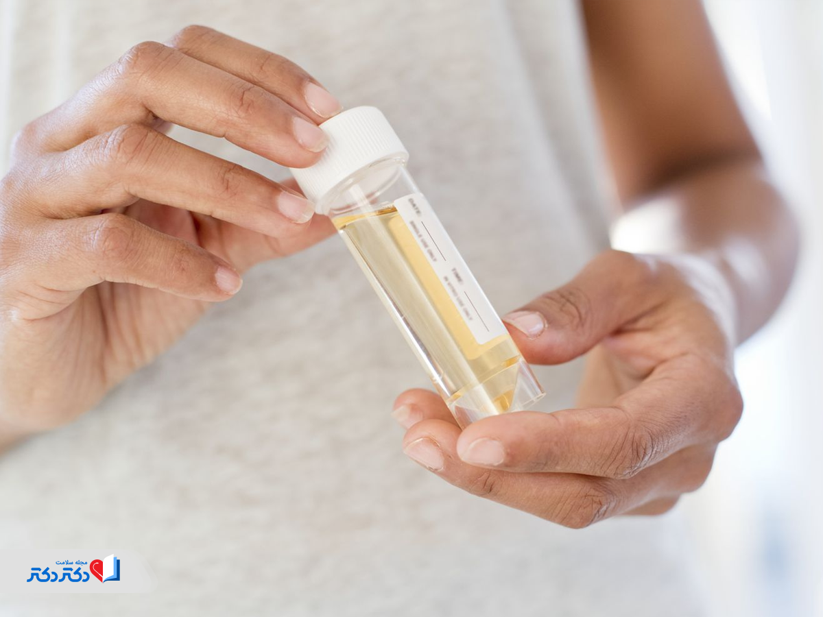 جمع‌آوری نمونه ادرار