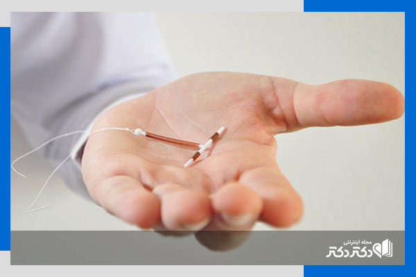 آی یو دی (IUD) برای جلوگیری از بارداری چیست؟ عوارض دستگاه آی یو دی