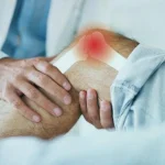 آرتریت در جوانان و سالمندان؛ انواع، علائم و راهکارهای کنترل