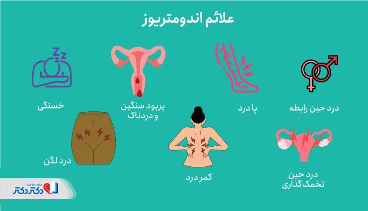 علائم اندومتریوز