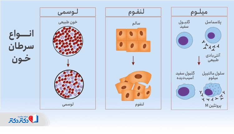 انواع سرطان خون
